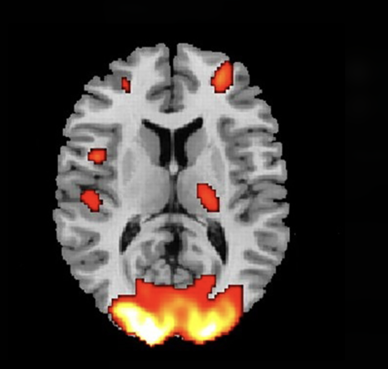 CVAE-in-FMRI Project Image